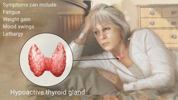 thyroid treatment torrance, ca | hypothyroidism